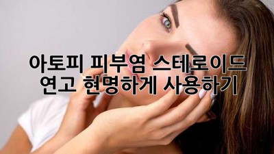 아토피 피부염, 스테로이드 연고 현명하게 사용하기